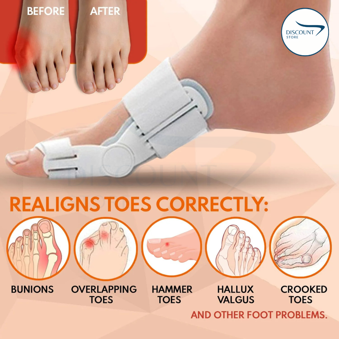 Pain Relief Bunion Toe Corrector - (IMPORTED W/ KNOB)