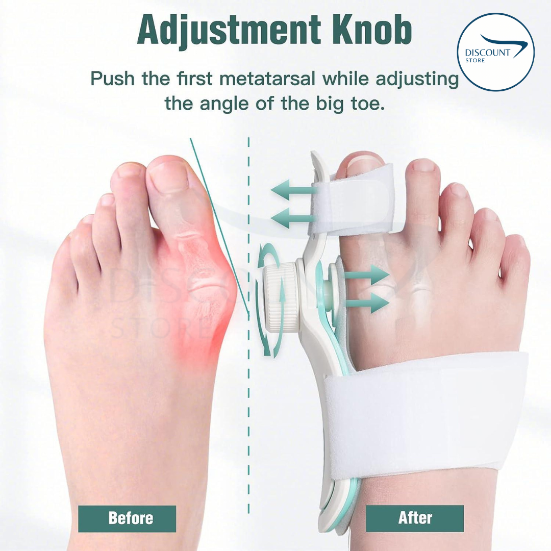 Pain Relief Bunion Toe Corrector - (IMPORTED W/ KNOB)